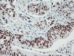 p53 Antibody in Immunohistochemistry (Paraffin) (IHC (P))