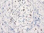 p53 Antibody in Immunohistochemistry (Paraffin) (IHC (P))