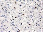 p53 Antibody in Immunohistochemistry (Paraffin) (IHC (P))