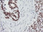 p53 Antibody in Immunohistochemistry (Paraffin) (IHC (P))