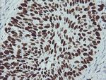 p53 Antibody in Immunohistochemistry (Paraffin) (IHC (P))