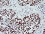 p53 Antibody in Immunohistochemistry (Paraffin) (IHC (P))