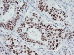 p53 Antibody in Immunohistochemistry (Paraffin) (IHC (P))