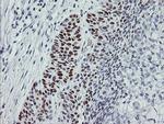 p53 Antibody in Immunohistochemistry (Paraffin) (IHC (P))