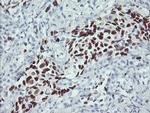 p53 Antibody in Immunohistochemistry (Paraffin) (IHC (P))