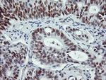 p53 Antibody in Immunohistochemistry (Paraffin) (IHC (P))