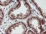 p53 Antibody in Immunohistochemistry (Paraffin) (IHC (P))