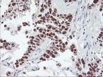 p53 Antibody in Immunohistochemistry (Paraffin) (IHC (P))