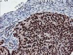 p53 Antibody in Immunohistochemistry (Paraffin) (IHC (P))