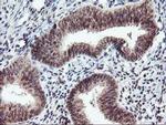 p53 Antibody in Immunohistochemistry (Paraffin) (IHC (P))