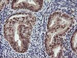p53 Antibody in Immunohistochemistry (Paraffin) (IHC (P))