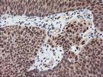 p53 Antibody in Immunohistochemistry (Paraffin) (IHC (P))