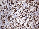 p53 Antibody in Immunohistochemistry (Paraffin) (IHC (P))