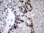 p53 Antibody in Immunohistochemistry (Paraffin) (IHC (P))