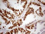 p53 Antibody in Immunohistochemistry (Paraffin) (IHC (P))