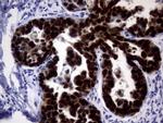 p53 Antibody in Immunohistochemistry (Paraffin) (IHC (P))