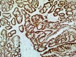 p53 Antibody in Immunohistochemistry (Paraffin) (IHC (P))