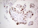p53 Antibody in Immunohistochemistry (Paraffin) (IHC (P))