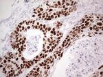 p53 Antibody in Immunohistochemistry (Paraffin) (IHC (P))