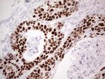 p53 Antibody in Immunohistochemistry (Paraffin) (IHC (P))