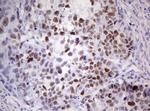 p53 Antibody in Immunohistochemistry (Paraffin) (IHC (P))