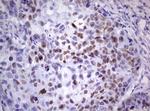p53 Antibody in Immunohistochemistry (Paraffin) (IHC (P))