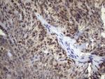p53 Antibody in Immunohistochemistry (Paraffin) (IHC (P))