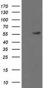 p53 Antibody in Western Blot (WB)