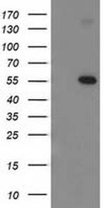 p53 Antibody in Western Blot (WB)