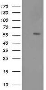 p53 Antibody in Western Blot (WB)