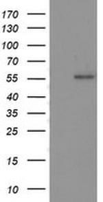 p53 Antibody in Western Blot (WB)