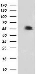 p53 Antibody in Western Blot (WB)