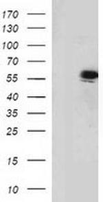 p53 Antibody in Western Blot (WB)