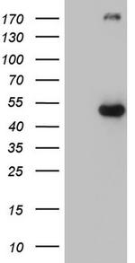 p53 Antibody in Western Blot (WB)