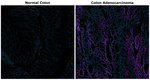 p53 Antibody in Immunohistochemistry (Paraffin) (IHC (P))