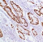 p53 Antibody in Immunohistochemistry (IHC)
