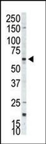RPS6KB2 Antibody in Western Blot (WB)