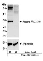 Phospho-RPA32 (Ser33) Antibody in Western Blot (WB)