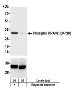 Phospho-RPA32 (Ser4, Ser8) Antibody in Western Blot (WB)