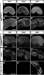 GFP Antibody in Immunohistochemistry (IHC)