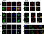 Calreticulin Antibody in Immunocytochemistry (ICC/IF)