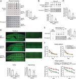 beta Amyloid Antibody in Dot Blot (DB)