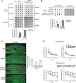 beta Amyloid Antibody in Dot Blot (DB)