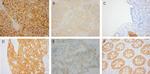 Claudin 4 Antibody in Immunohistochemistry (IHC)