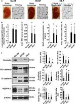 E-cadherin Antibody in Western Blot (WB)