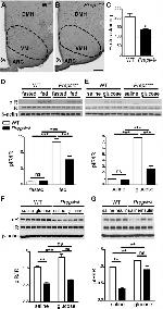 Phospho-INSR (Tyr972) Antibody in Western Blot (WB)