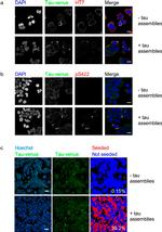 Tau Antibody in Immunocytochemistry (ICC/IF)