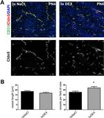 Claudin 5 Antibody in Immunohistochemistry (IHC)