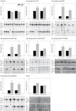 Phospho-Tau (Thr231) Antibody in Western Blot (WB)