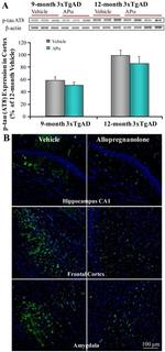Phospho-Tau (Ser202, Thr205) Antibody in Western Blot, Immunohistochemistry (WB, IHC)